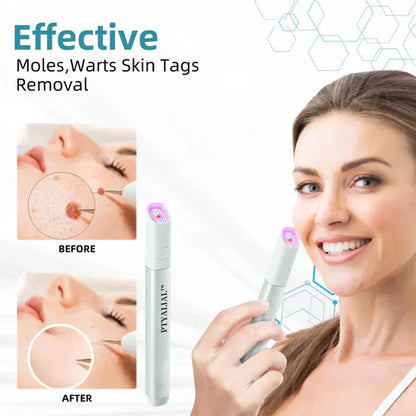 ✨Ptyalial™ All-in-One CO₂ Laser Eraser Pen | Removes Moles, Warts, Skin Flaws & Pigmentation