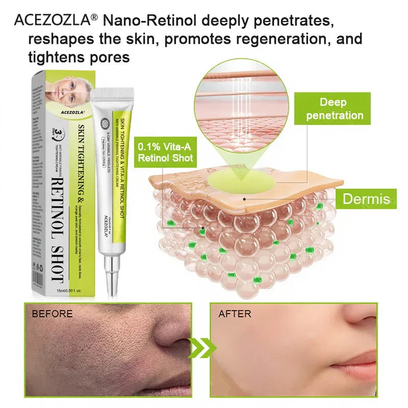 ✨Final 5 Hours: 70%OFF🔥Acezozla™ Botulinum & Vita-A Retinol Shot Wrinkle-Lift Tightening cream✨