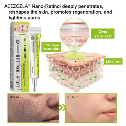 ✨Final 5 Hours: 70%OFF🔥Acezozla™ Botulinum & Vita-A Retinol Shot Wrinkle-Lift Tightening cream✨