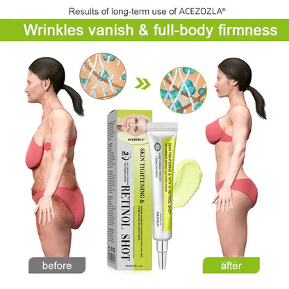 ✨Final 5 Hours: 70%OFF🔥Acezozla™ Botulinum & Vita-A Retinol Shot Wrinkle-Lift Tightening cream✨