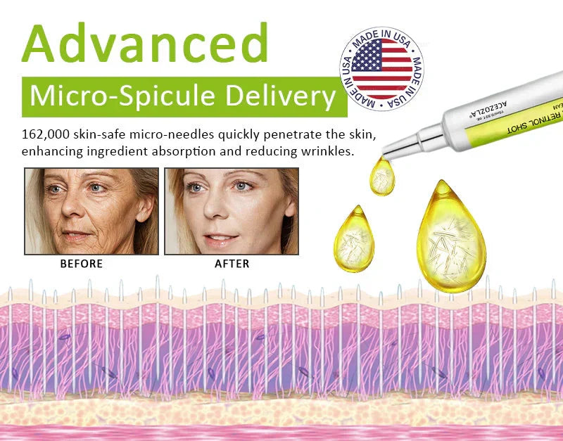 ✨Final 5 Hours: 70%OFF🔥Acezozla™ Botulinum & Vita-A Retinol Shot Wrinkle-Lift Tightening cream✨
