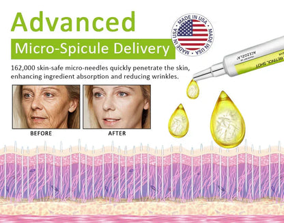 ✨Final 5 Hours: 70%OFF🔥Acezozla™ Botulinum & Vita-A Retinol Shot Wrinkle-Lift Tightening cream✨