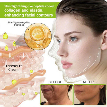 ✨Final 5 Hours: 70%OFF🔥Acezozla™ Botulinum & Vita-A Retinol Shot Wrinkle-Lift Tightening cream✨