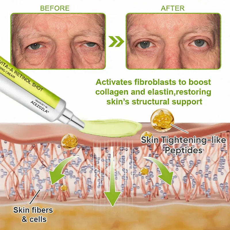 ✨Final 5 Hours: 70%OFF🔥Acezozla™ Botulinum & Vita-A Retinol Shot Wrinkle-Lift Tightening cream✨